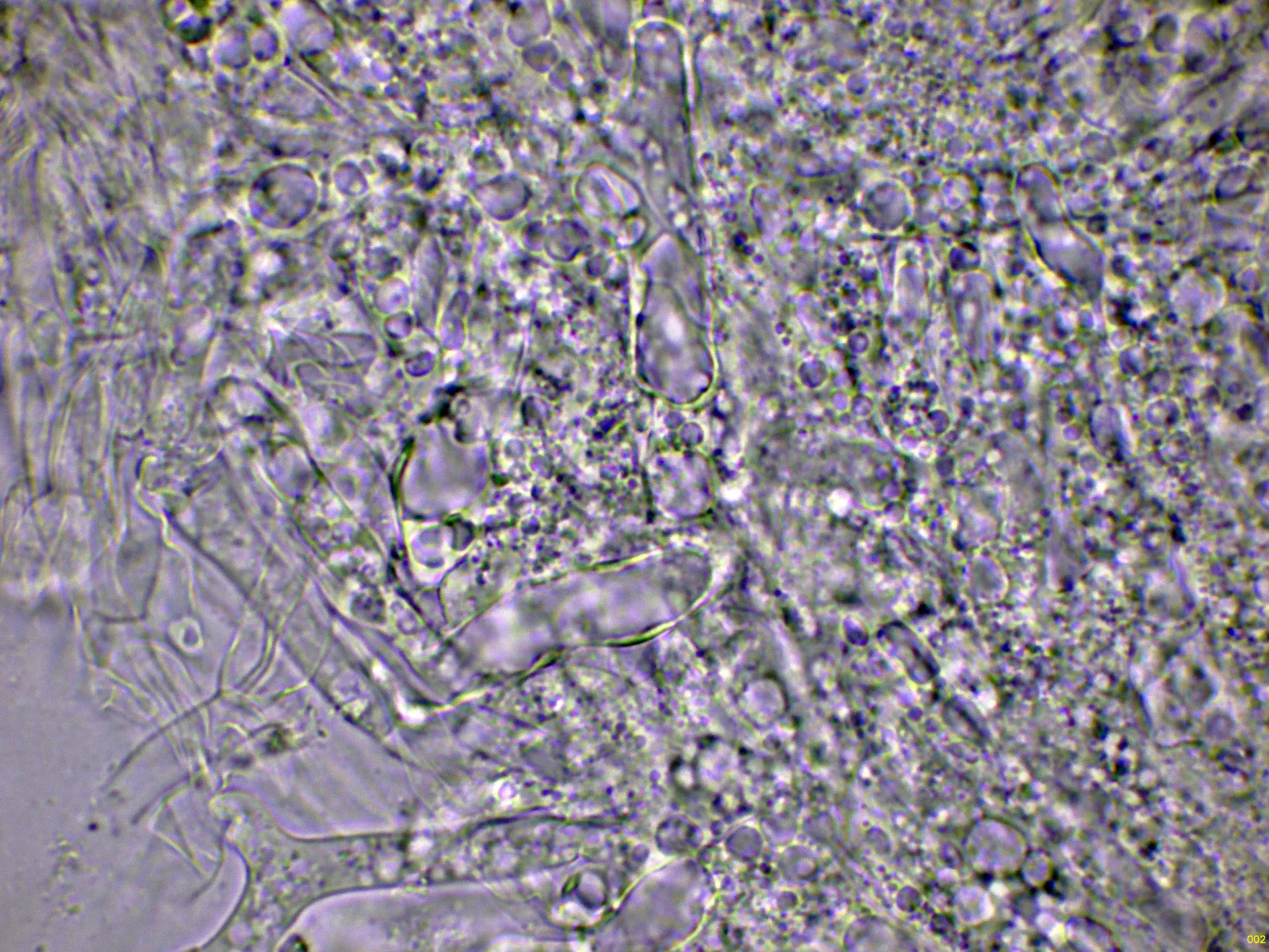 Microscopía de Lepista irinoides - 10 - Subpellis agua-002